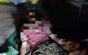 حمله خرس به نوجوان در سبزکوه بروجن حمله خرس به نوجوان در سبزکوه بروجن