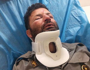 دومین حمله به حافظان طبیعت در شمیرانات دومین حمله به حافظان طبیعت در شمیرانات؛ این بار ضرب و شتم یک محیط بان