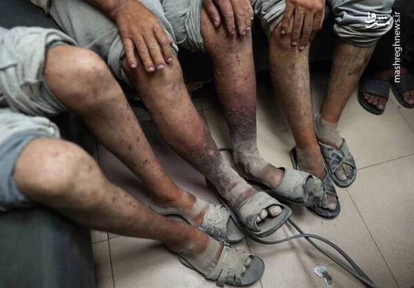 آزمایش سلاحهای جدید اسرائیل روی بدن اسرا