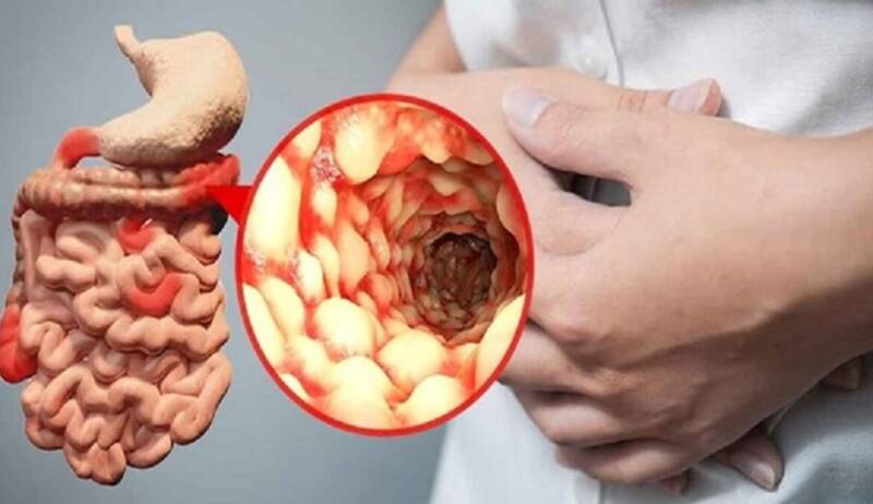 نقش حیاتی ویتامین B۱۲ در سلامت جسم و روان انسان