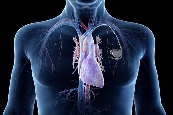 چربي،قلب،پيري،احشايي،محققان،مرتبط،بدن،وزن،زنان،اورگان،رسوبات