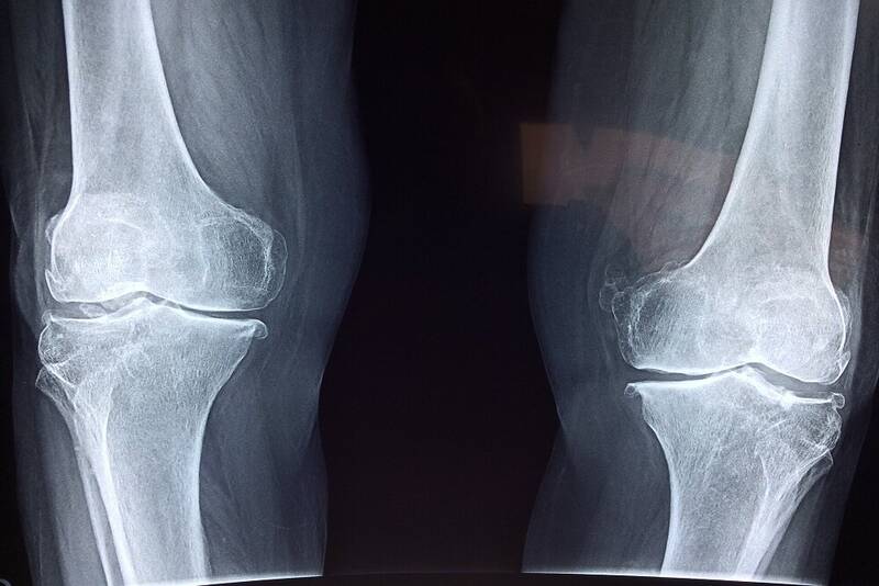 طب،استخوان،مواد،ايراني،مكمل،سلامت،ضروري،هضم،دفع،تغذيه،بدن،جذ ...