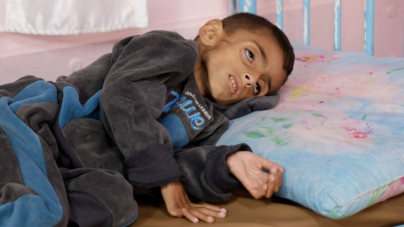 غزه،كودك،سوءتغذيه،نوار،سازمان،يونيسف