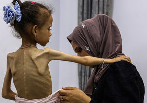 سوءتغذیه‌ی کودکان در غزه