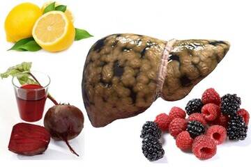 راهکارهای طلایی برای جلوگیری از کبد چرب 3