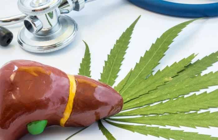 راهکارهای طلایی برای جلوگیری از کبد چرب 4