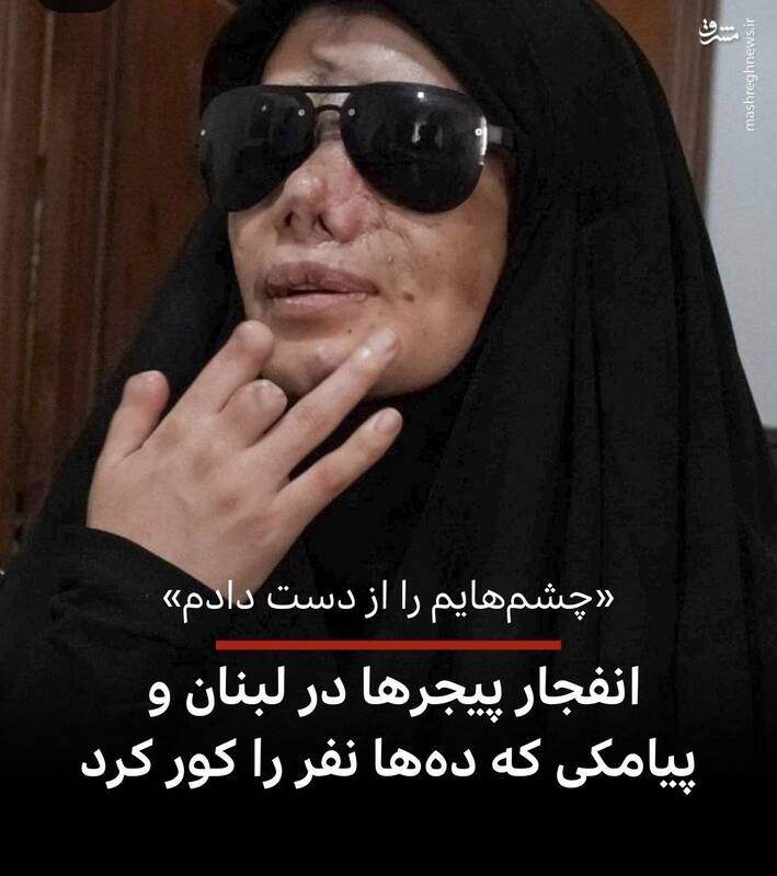 جانبازانی که هنوز پای کار مقاومت هستند