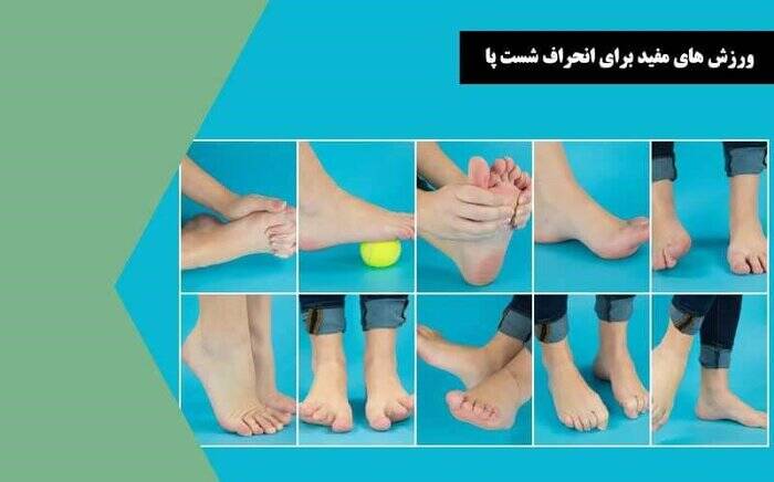 راهکارهایی ساده برای اصلاح انگشتان پا 4