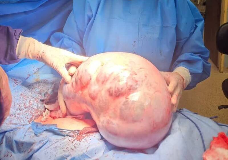 بيمار،شكمي،محمديان،غيرطبيعي،دردهاي