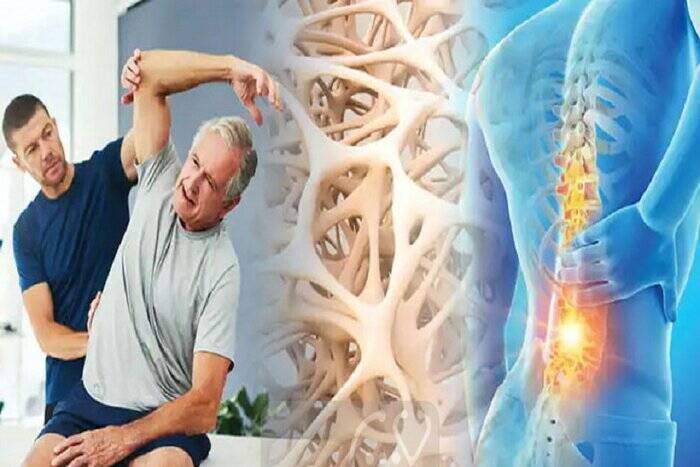 پوکی استخوان؛ دشمن خاموش سالمندی