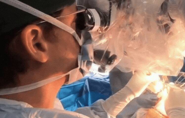 جراحي،تكلم،تومور،بيهوشي