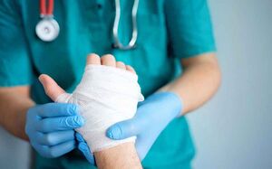 90 درصد سوختگی‌ها قابل پیشگیری است