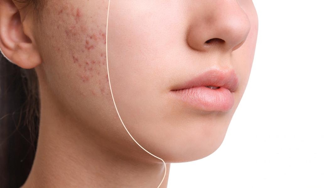 روش استفاده درست از محصولات مراقبت پوستی الانزا؛ راهنمای استفاده از کرم دور چشم، پد آرایش پاکن و پنبه و تونر صورت لافارر