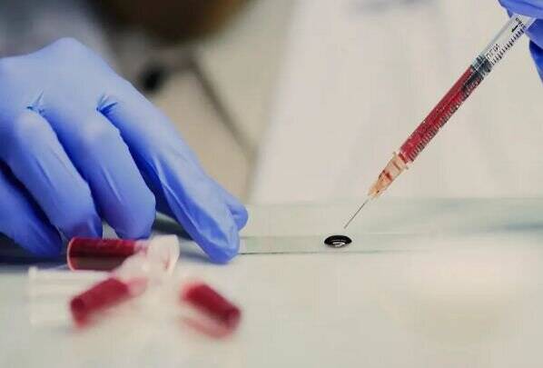 ايران،دوپينگ،نادو،وادا،نمونه،كنترل،ممنوعه