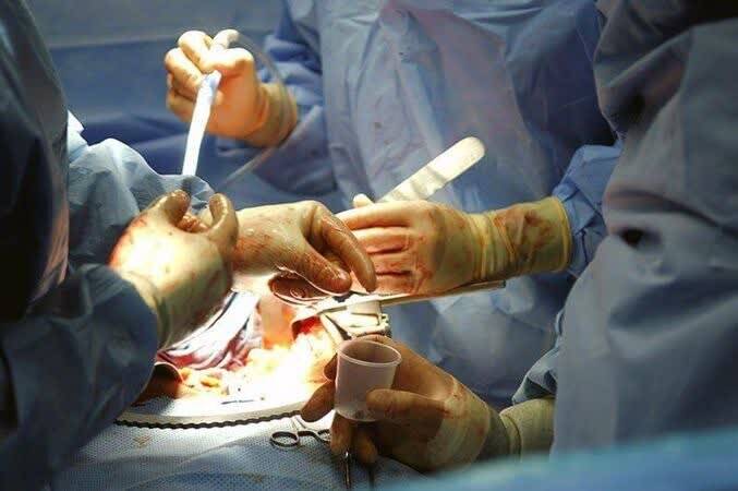 تفاوت کما و مرگ مغزی؛ مرزی میان امید و اهدای زندگی 4