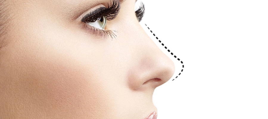 جراحی بینی در ایلام؛ از انتخاب پزشک تا دوران نقاهت