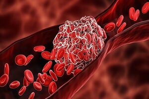 دشمن خاموش رگ‌ها