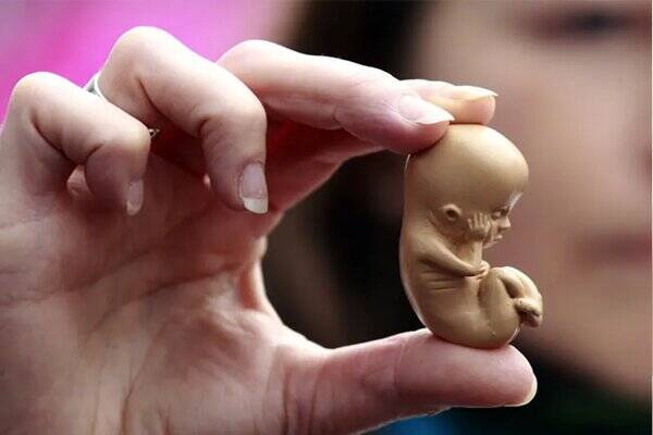 رحم،غيرقانوني،سقط،دهانه،پارگي،مشيري