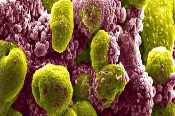 گروه،سرطان،درمان،پروستات،تركيبي،استاندارد،درماني،دريافت،بيما ...