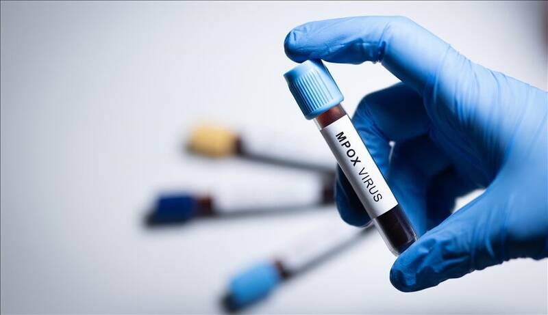 پاكس،ويروس،شيوع،اخيرا