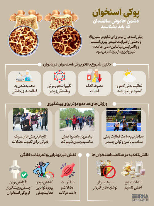 نمودار زندگی/ پوکی استخوان؛ دشمن خاموش سالمندی