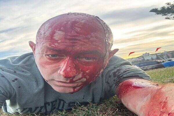 حاخام معروف در حنوکای خونین کشته شد