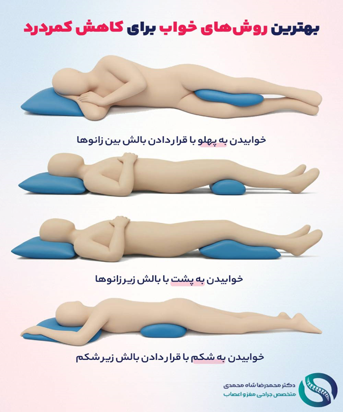 بهترین ورزش و روش خوابیدن برای دیسک کمر و کاهش کمردرد