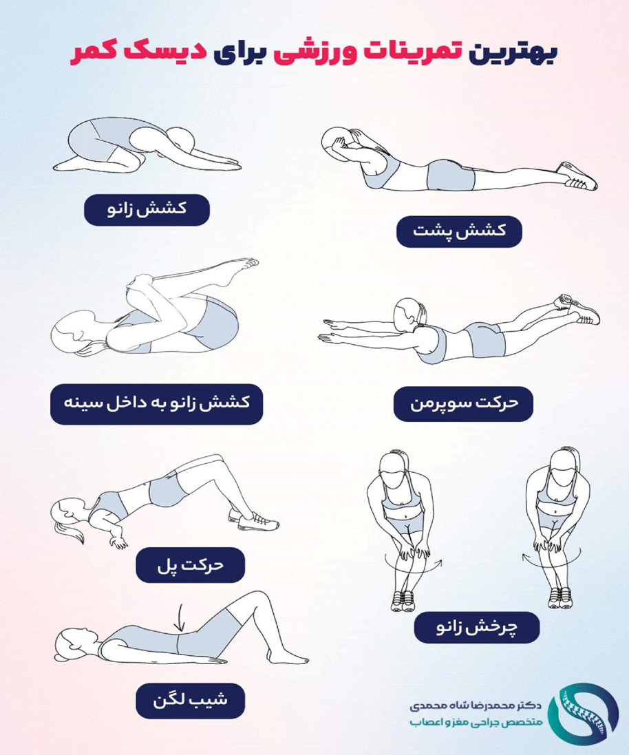 بهترین ورزش و روش خوابیدن برای دیسک کمر و کاهش کمردرد