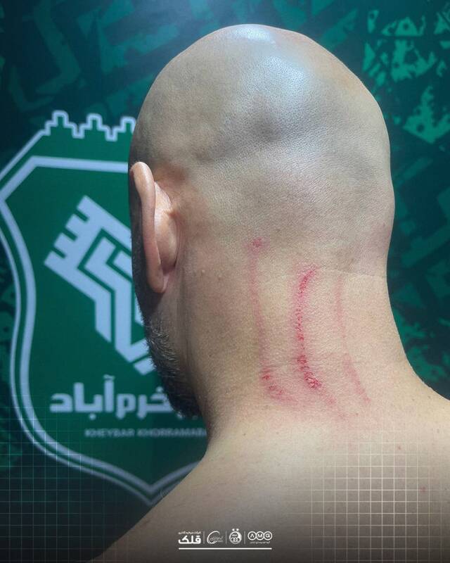 زخمی شدن مربی استقلال در پایان دیدار با خیبر +عکس