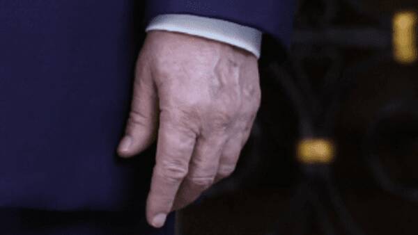 دست،ايكس،سوراخ،كاربران،چپ،راست