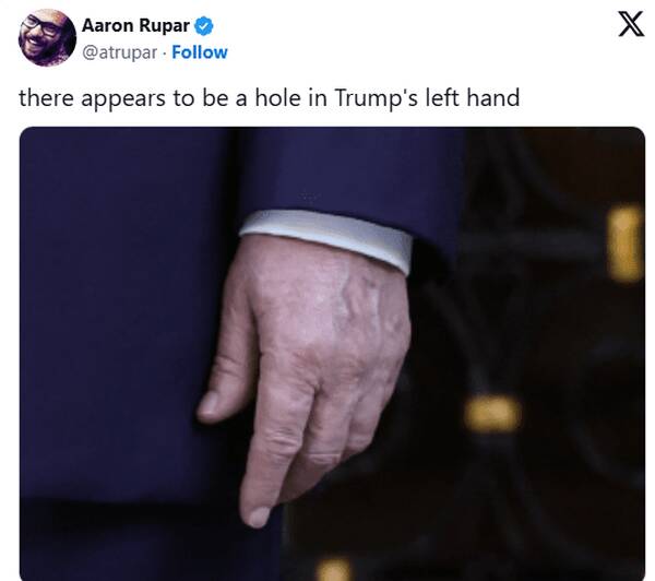 شایعات در مورد سلامتی ترامپ، دوباره بالا گرفت + عکس