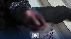 فیلم/ انفجار نارنجک دستی در دستان جوان ملاردی