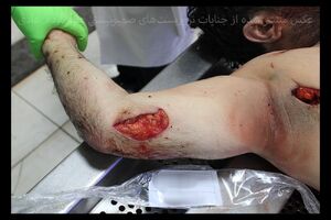 دیدن تصاویر این گزارش برای هر کسی مناسب نیست/ تروریست‌ها هیچ رحمی به مردم عادی نکردند/ بدن‌هایی که با قمه، دشنه و چاقو‌های بلند سوراخ‌سوراخ شده‌اند