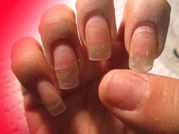 نقاشی سرطان روی ناخنها!