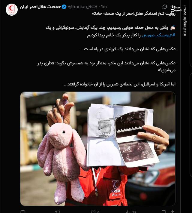 برگه سونوگرافی و عروسک صورتی