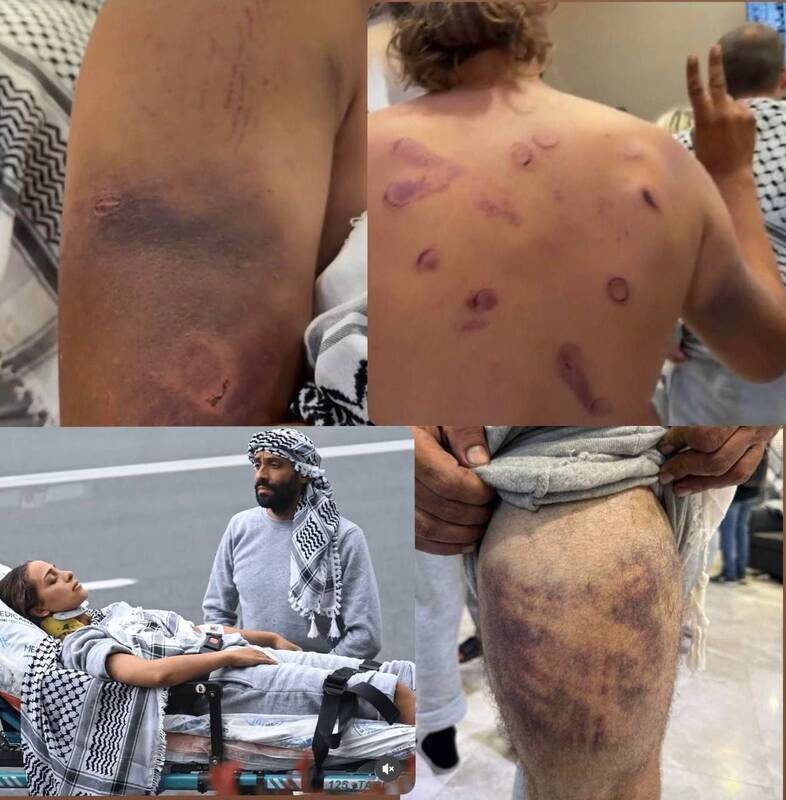 کاروان صمود؛ آزمون اخلاقی جهان در برابر تحقیر انسانیت/ وقتی یک وزیر عربده کش، رژیم صهیونیستی را منزوی‌تر کرد