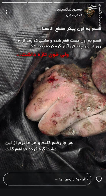 مشت گره کرده شهید تنگسیری در لحظه شهادت