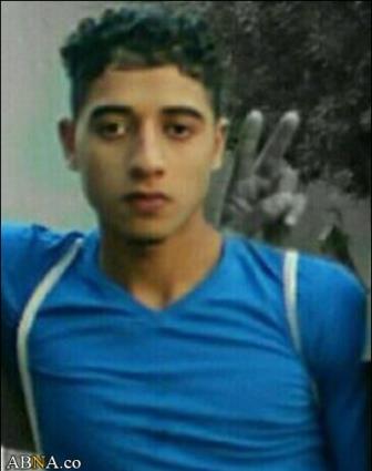 نوجوان بحرینی در آستانه شهادت+عکس