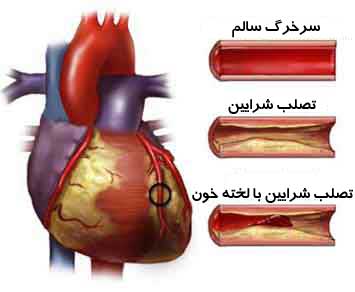 از توصیه سرفه و نفس عمیق تا ممنوعیت دادن خوراکی و آشامیدنی