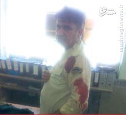 زخمی شدن 4پلیس درمواجهه با شرور آبادانی+عکس
