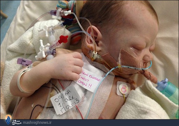 نجات جان یک نوزاد با بافت قلب گاو+عکس