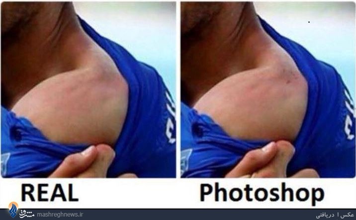 جای دندان سوارز فتوشاپ است +عکس جای دندان سوارز فتوشاپ است +عکس