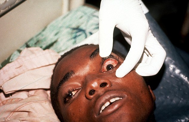 تصاویری ترسناک از مبتلایان به ابولا در افریقا
