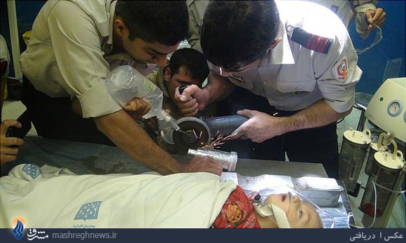 چرخ‌گوشت دست کودک 18‌ماهه را بلعید+تصاویر