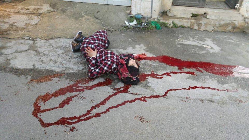 تماشای جان‌دادن دختر فلسطینی از سوی نظامیان صهیونیست + عکس