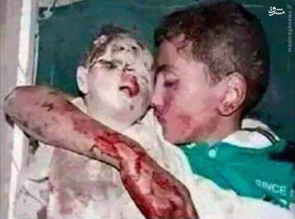 افشاگری‌های تازه درباره یمن/ هلاکت 10هزار نیروی سعودی در 333 روز/ مزدوران سعودی چقدر حقوق‌می‌گیرند+نقشه،فیلم و عکس(18+)