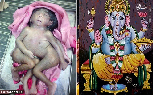 پرستش یک کودک ناقص الخلقه در هند!!!/عکس