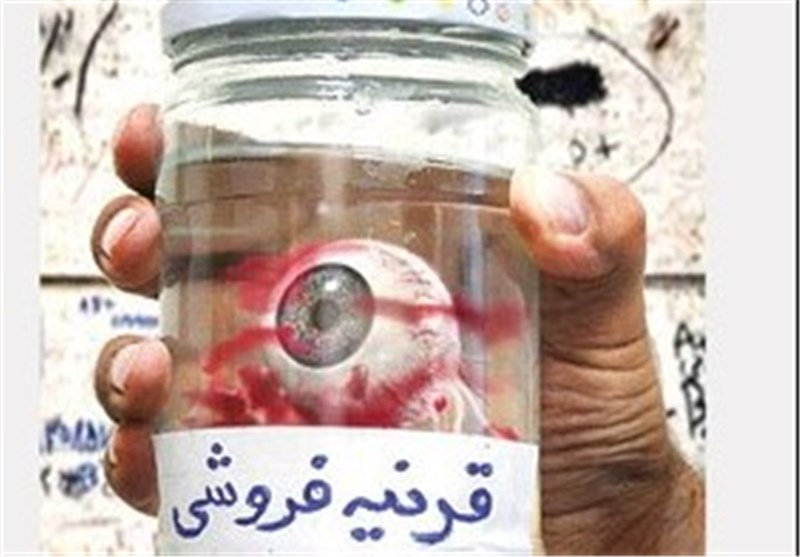 «فروش قرنیه چشم در ایران»؟+عکس