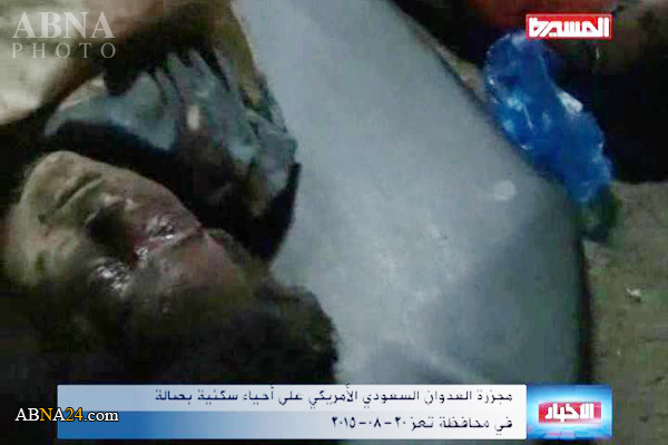 قتل عام مردم شهر «تعز» یمن به دست رژیم سعودی + عکس