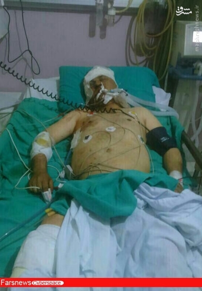 اولین تصویر از خبرنگار مجروح ایرانی در سوریه